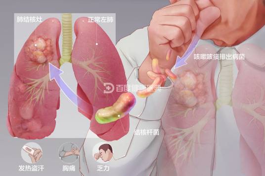 肺结核