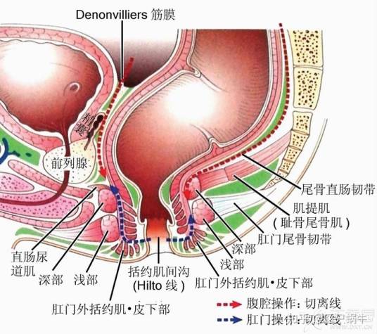 直肠损伤