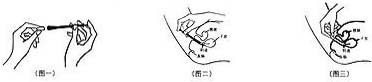 克霉唑阴道片使用方法