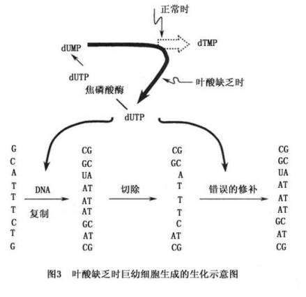 巨幼红细胞性贫血