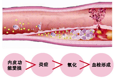 预防