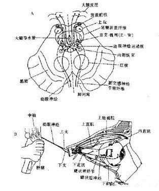 动眼神经麻痹