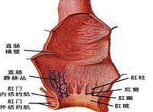 排粪时肛门灼痛