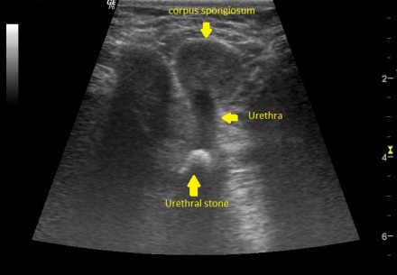 尿道结石案例（超声检查） 