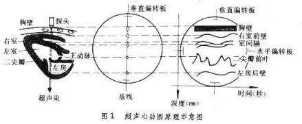 超声心动图