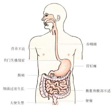 人体示意图