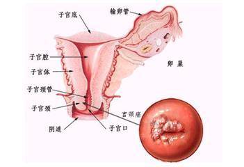 抗内膜抗体阳性