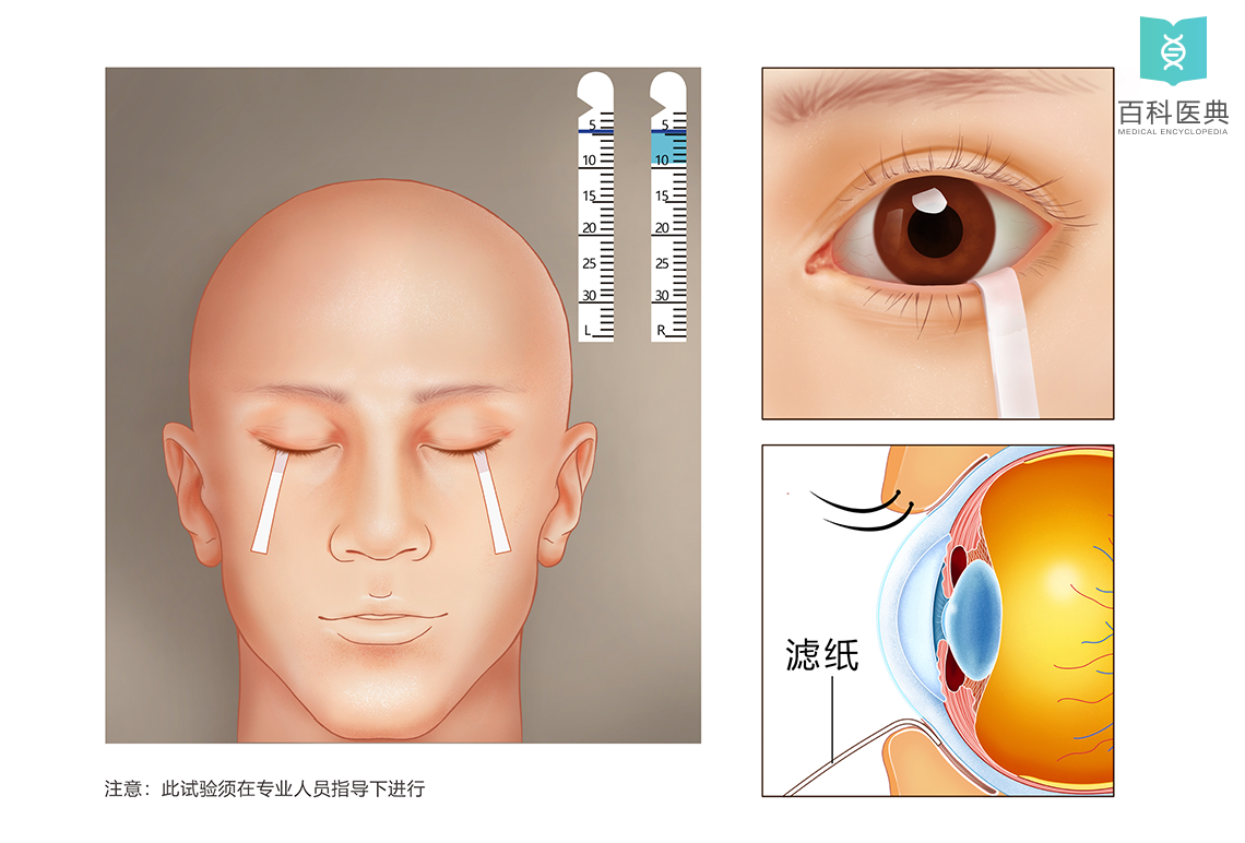 泪液分泌试验