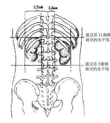 肾周围炎