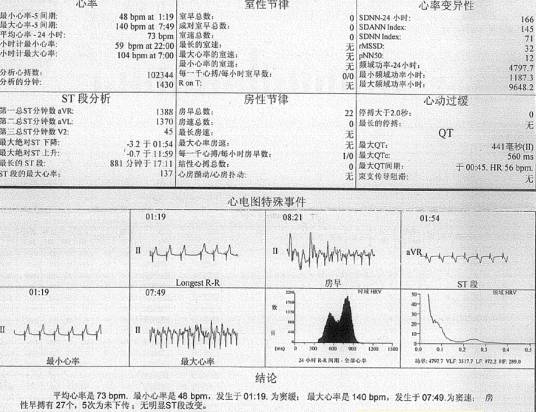 心律不齐