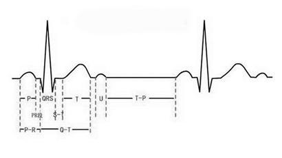 心电图异常