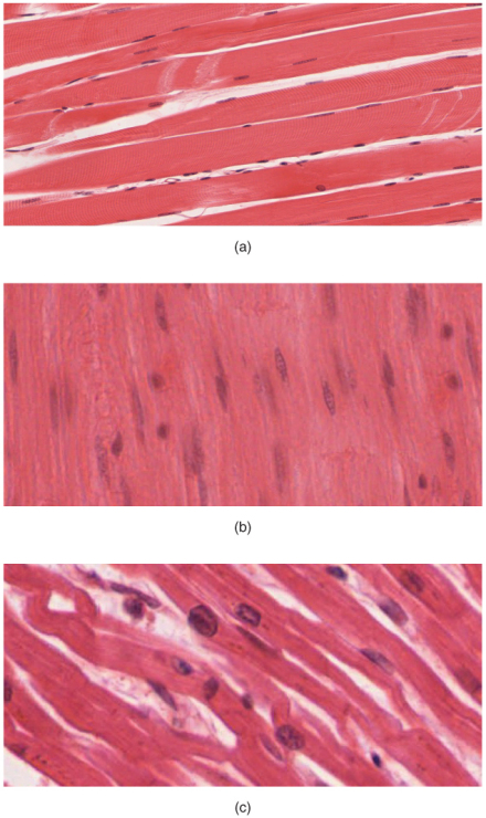 人体三种肌肉组织（a.骨骼肌；b.平滑肌；c.心肌） 