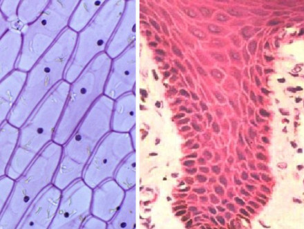 洋葱表皮细胞（左）与人口腔上皮细胞（右）