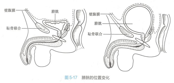 膀胱空虚时、充盈时的形态与位置变化（示前列腺）