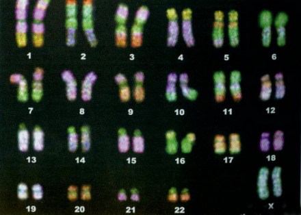 在人类的体细胞中发现的23对染色体