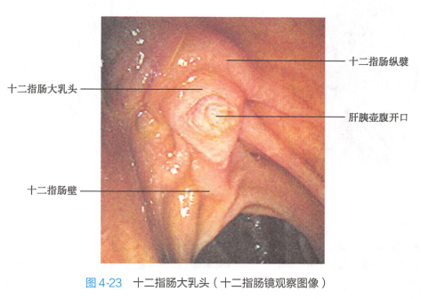 十二指肠大乳头