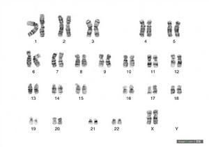 人类染色体图片