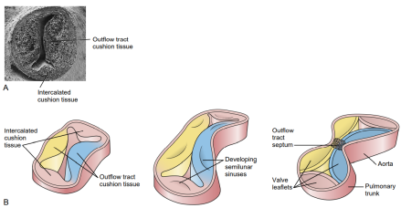 主动脉和肺动脉瓣的发生