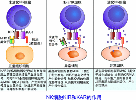 自然杀伤细胞（NK细胞）